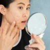 7 Rekomendasi Moisturizer yang Cocok untuk Kulit Berjerawat