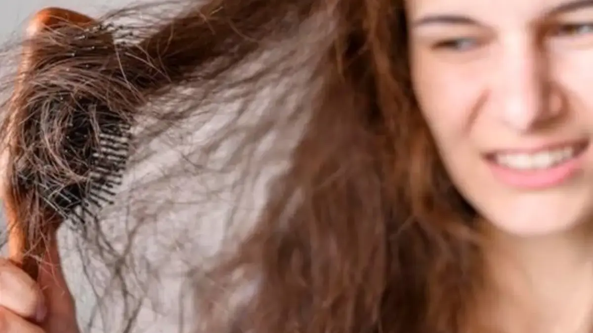 Wajib Tahu! 5 Jenis Rambut Rontok Yang Biasa Terjadi Pada Wanita